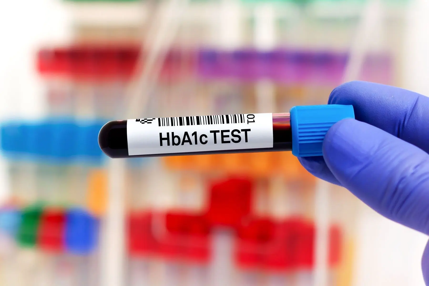 HbA1c Blood Test vial